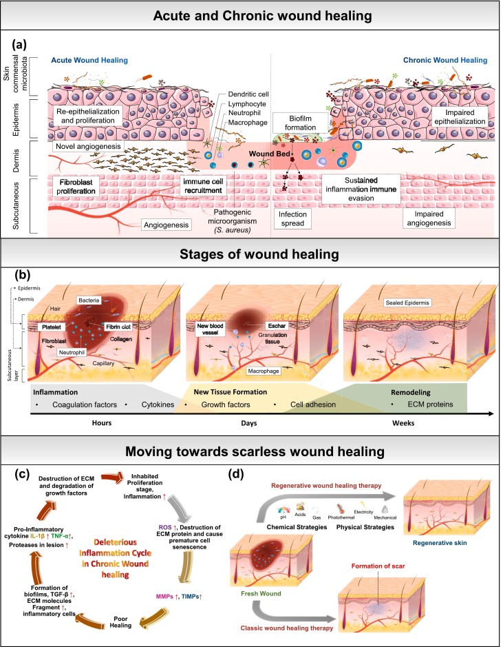 Wound healing phases: Inflammation (0-48h), New tissue formation (2-10 days), Remodeling (1-12 months), and comparison of acute vs chronic wound progression
